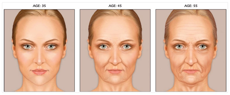 The Importance of Buccal Fat Removal in Facelift Surgery image 2