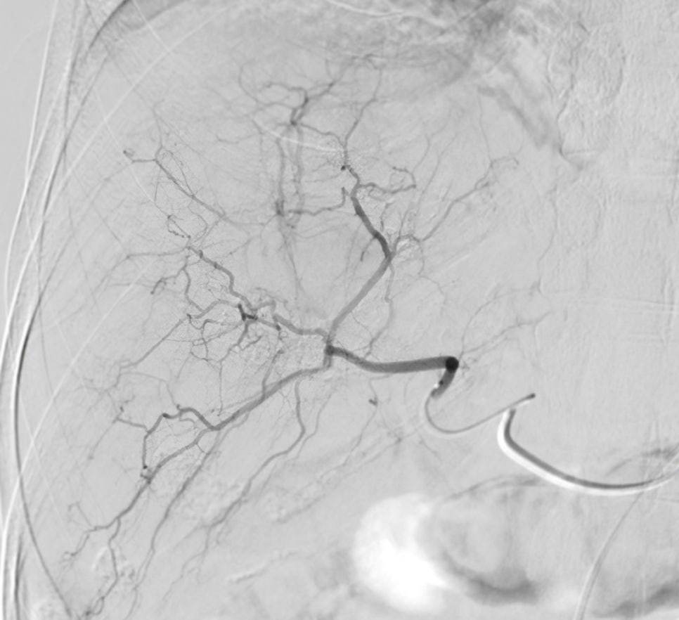 What kinds of massive bleeding can occur during facial contouring surgery? image 4