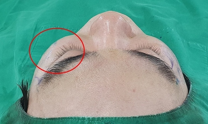 사례로 알아보는 45도광대 쉐이빙효과 분석 관련 이미지 2