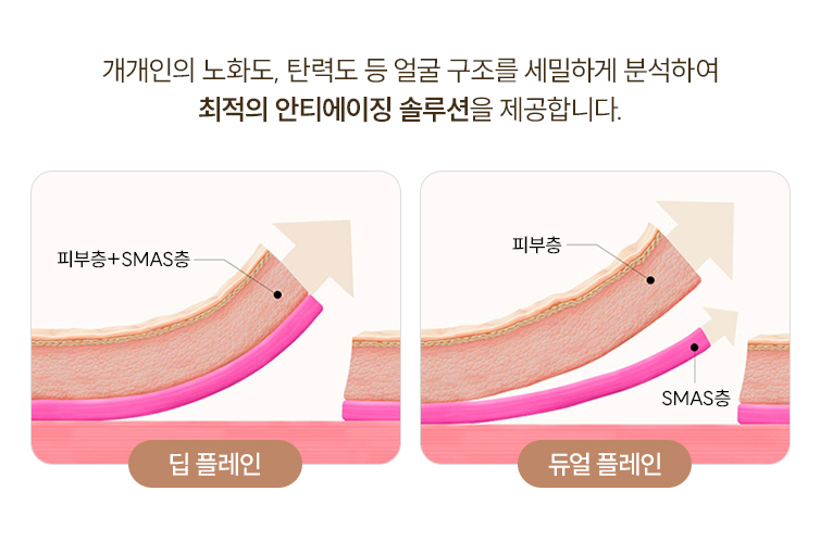 SMAS 안면거상과 Deep Plane(딥플레인) 이름만 보고 비교하면 안되는 이유 관련 이미지 2