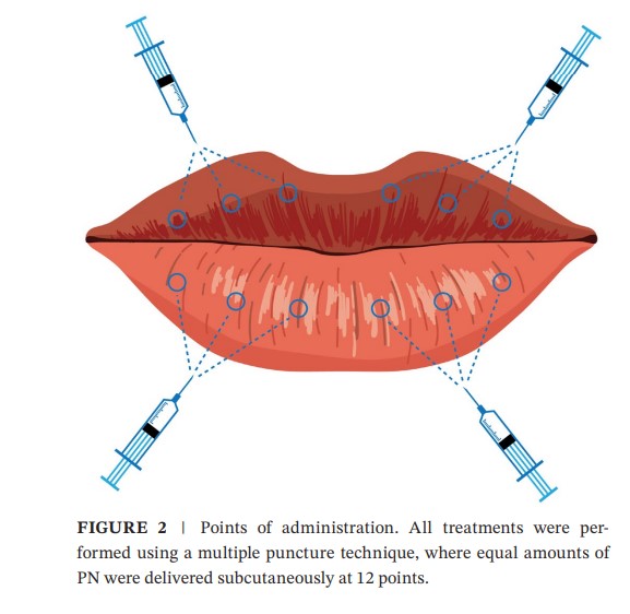 [Paper Review] What Is the Trending Lip Rejuran, "Lipjuran"? image 4