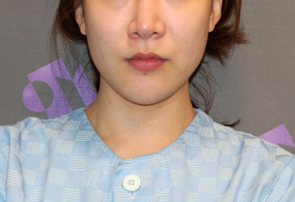 쉐이빙할 수 있는 부위와 효과는 어느정도 되나요? 관련 이미지 6