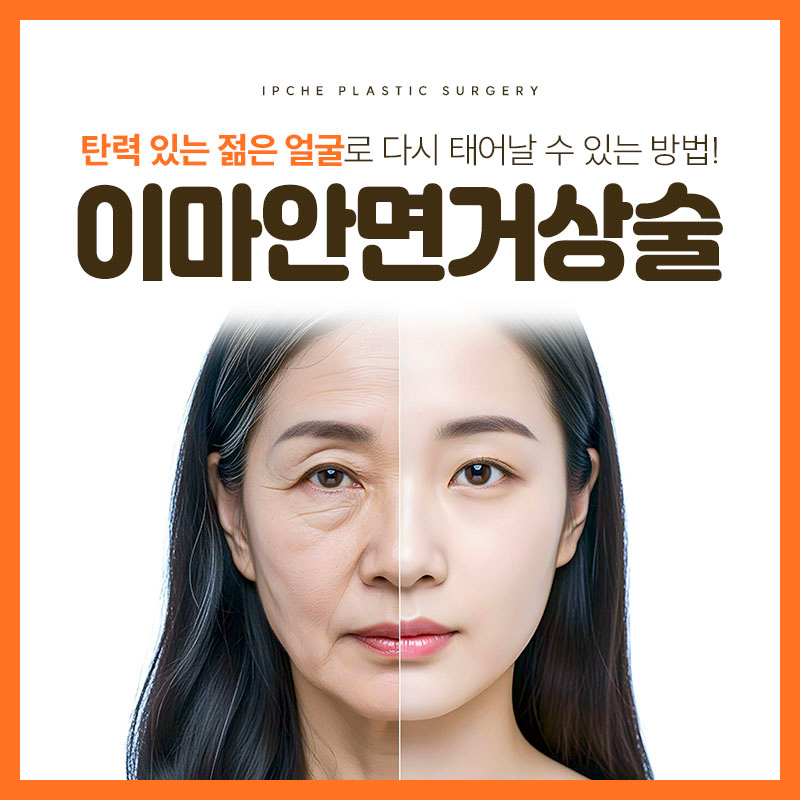 SMAS Facelift Effective for Improving Facial Sagging and Wrinkles image 1