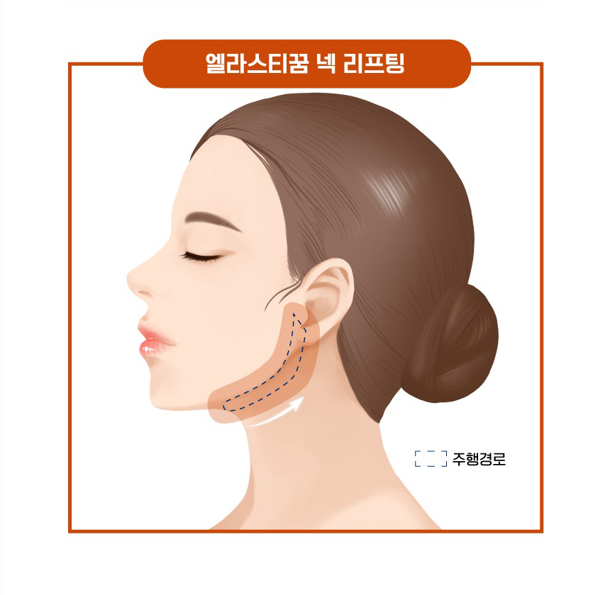 사각턱수술 후 사라진 턱선은 어떻게 해야할까요? (feat.엘라스티꿈 목리프팅) 관련 이미지 8