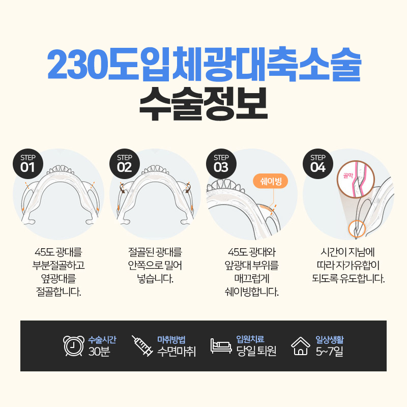안면윤곽수술, 처음부터 끝까지 A to Z 관련 이미지 7