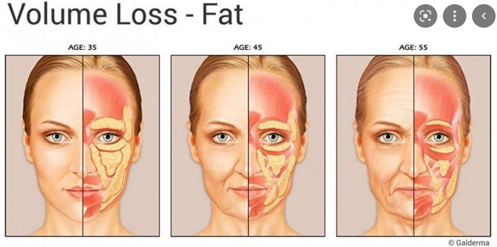 Is facial contouring surgery possible even at an older age? Important things you should know image 1
