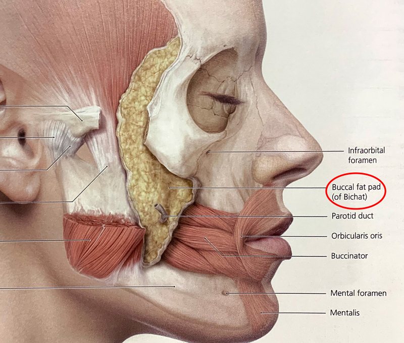 Is it good to combine facial contouring surgery with buccal fat removal? image 1