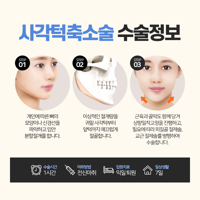 안면윤곽수술, 처음부터 끝까지 A to Z 관련 이미지 4