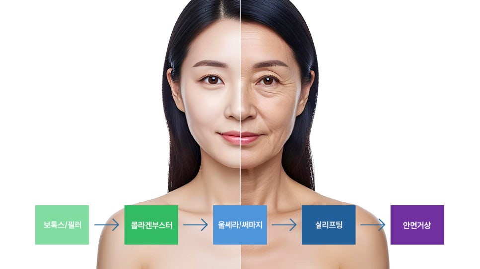 콜라겐주사 이후 안면거상 수술은 더 어려워질까? (1) 관련 이미지 1