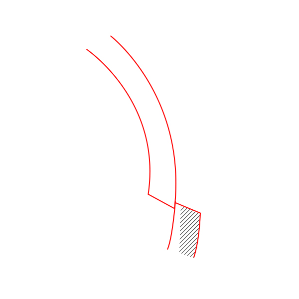 Back Cheekbone Shaving? Osteotomy? Do You Really Need It? image 8