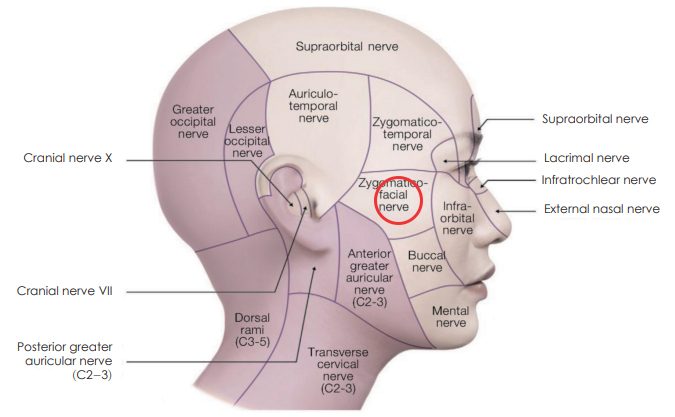 A Complete Summary of 6 Complications After Cheekbone Surgery: Sinusitis, Recurrence, Hollow Cheeks, and Sagging Cheeks image 12