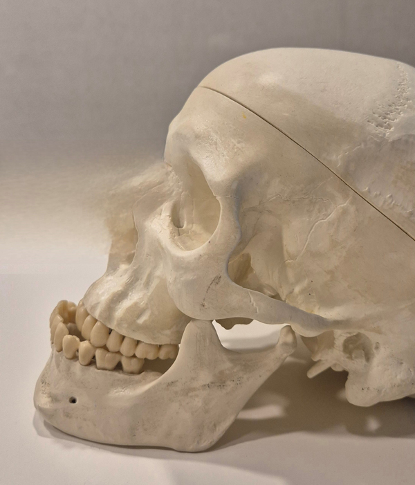 Which Surgery Do I Need: Contouring Surgery or Double-Jaw Surgery? image 2