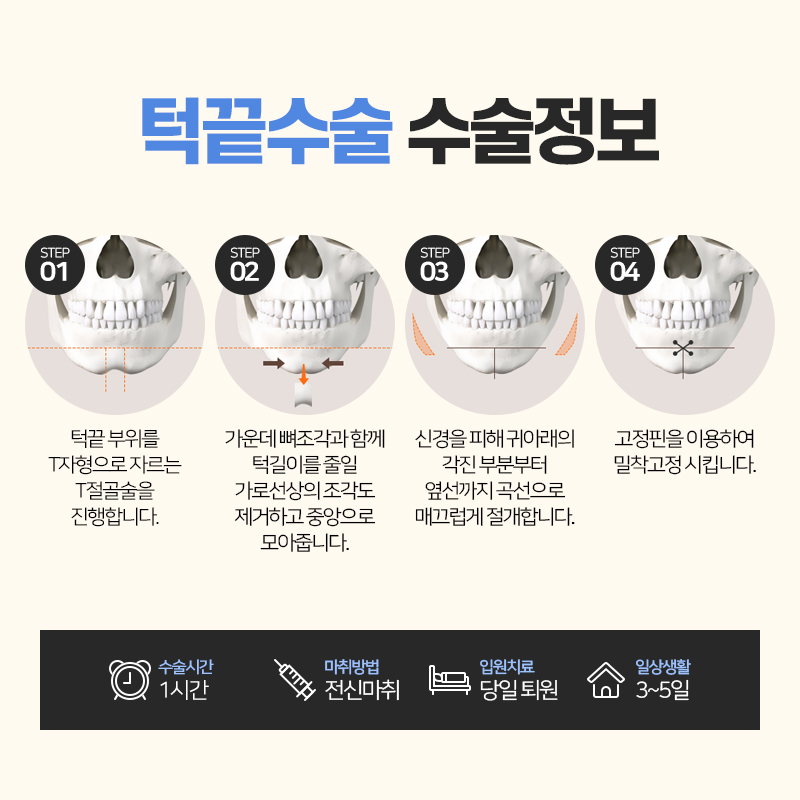 안면윤곽수술, 처음부터 끝까지 A to Z 관련 이미지 5