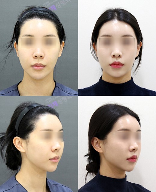 <span class="pcol3">[공지] 관련 이미지 7