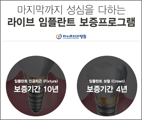 어금니임플란트 심미성과 기능을 한 번에! 관련 이미지 6
