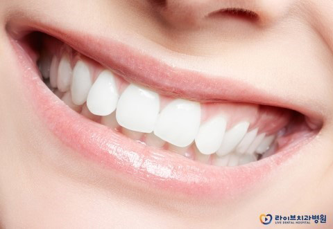 클리피씨교정, 치아교정기간 단축이 가능하다? 관련 이미지 2