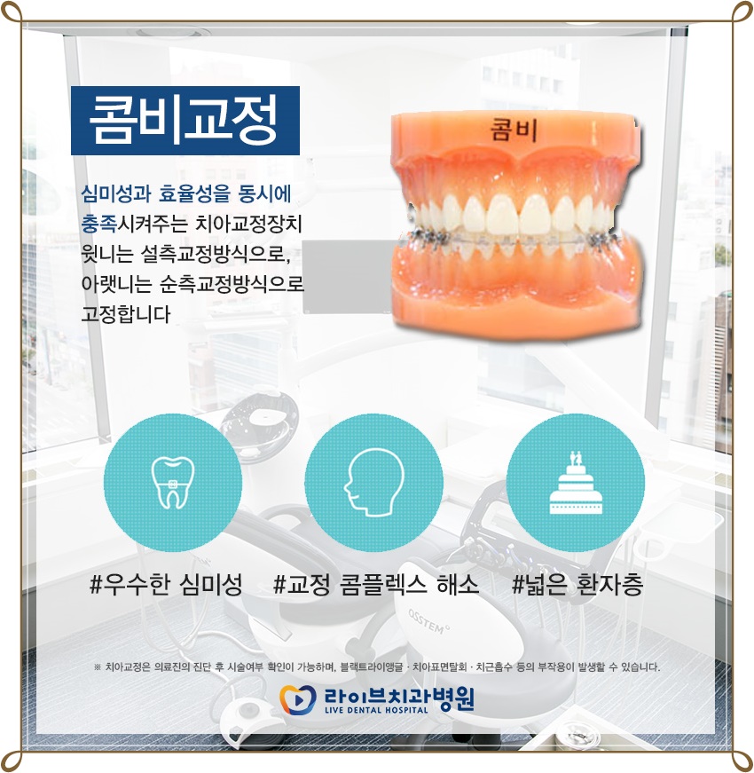 치아교정장치종류 알맞게 교정받자! 관련 이미지 3