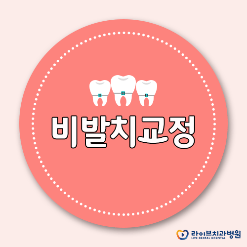 비발치교정, 발치없이 찾는 가지런한 치열 관련 이미지 1