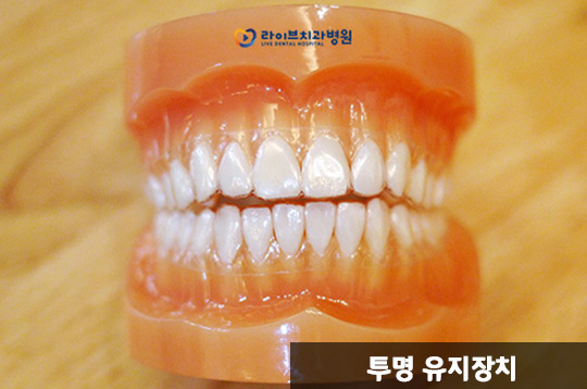 치아교정 유지장치, 왜 착용해야 할까? 관련 이미지 5