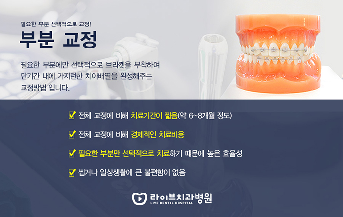 치아교정기간 왜 다를까 관련 이미지 3