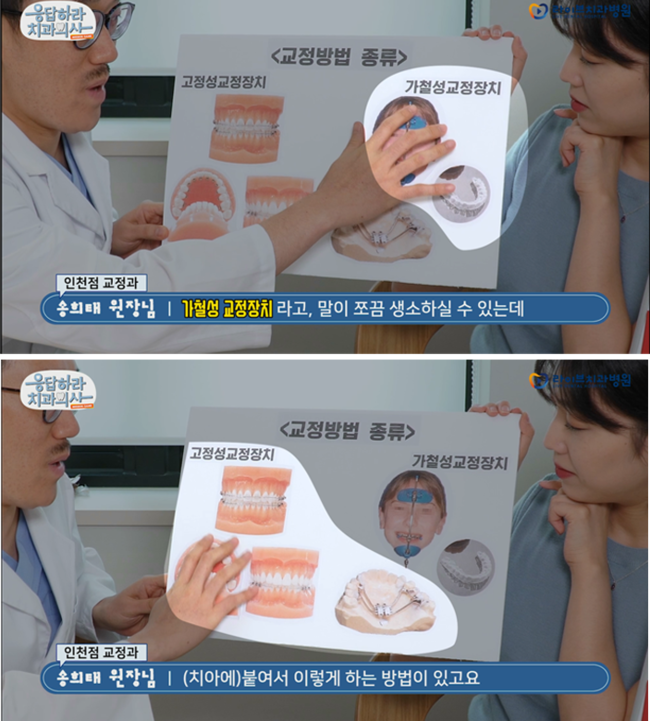 [5월세미나]교정 구내장치의 종류 - 강남점 스텝세미나 관련 이미지 3