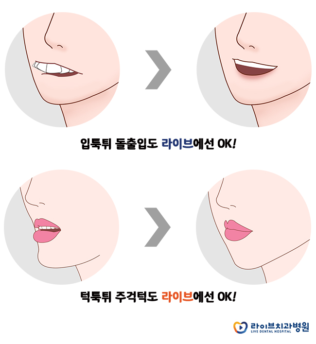 [수험표할인]라이브치과 치아교정 수능이벤트 관련 이미지 4