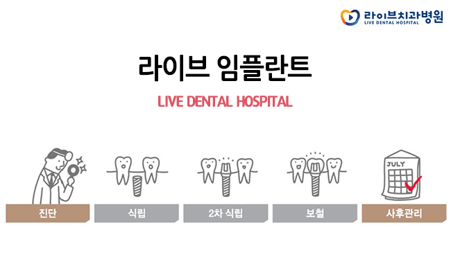 인천임플란트, 꼼꼼히 따져보고 결정하세요(: 관련 이미지 4