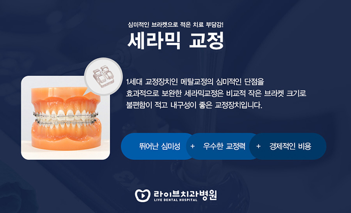 서초동 세라믹교정 알아볼까요? 관련 이미지 2