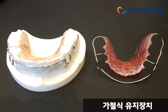 치아교정 유지장치, 왜 착용해야 할까? 관련 이미지 4