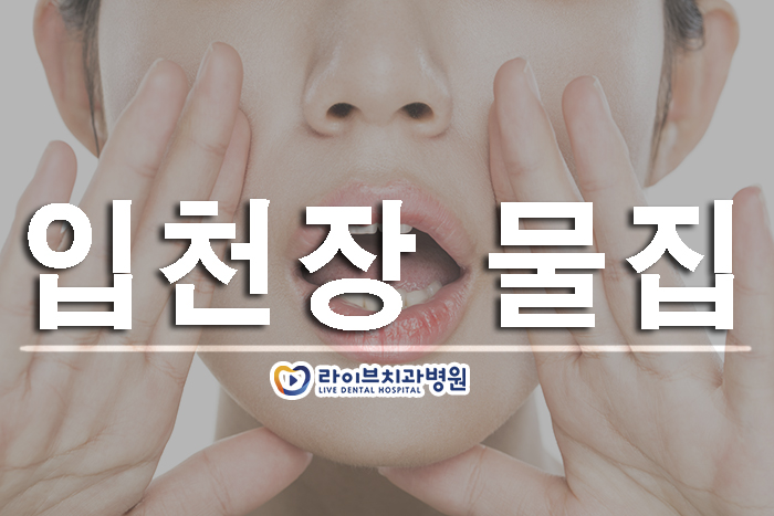 입천장 물집 어떻게 해요? 관련 이미지 1