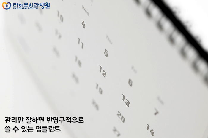 임플란트 장단점 차이가 궁금하다면! 관련 이미지 3