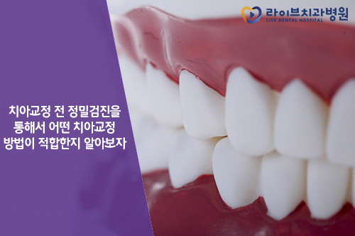 치아교정가격, 합리적으로 알아보기 위해선? 관련 이미지 4