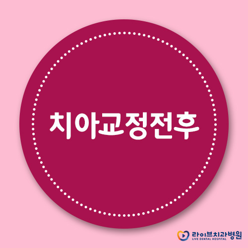 치아교정전후, 나의 달라질 모습을 기대하며 관련 이미지 1