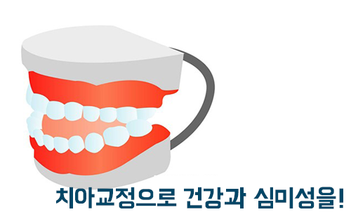부정교합 치아교정으로 치료할 수 있다?! 관련 이미지 4