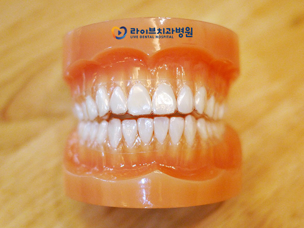 투명교정, 티나지 않게 미소에 자신감을! 관련 이미지 3