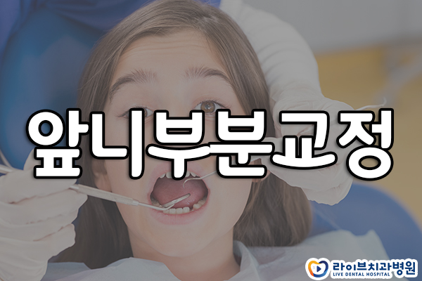 앞니부분교정 걸리는 기간은? 관련 이미지 1