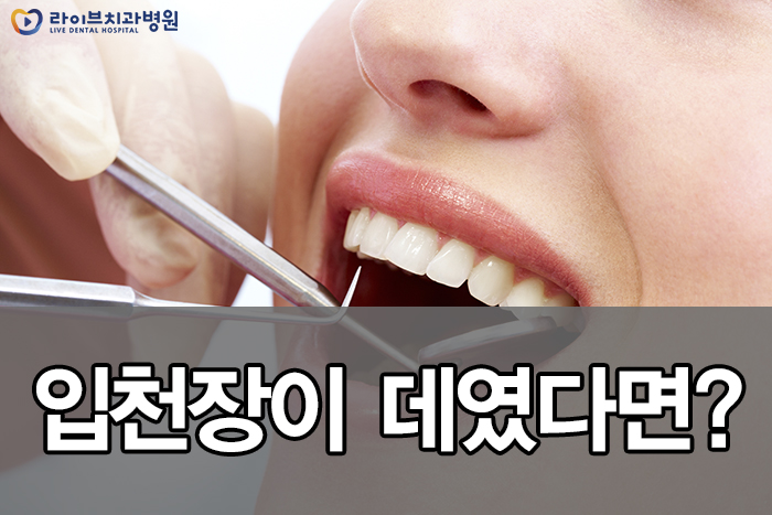 입천장 데였을때 어떻게 하죠 관련 이미지 1