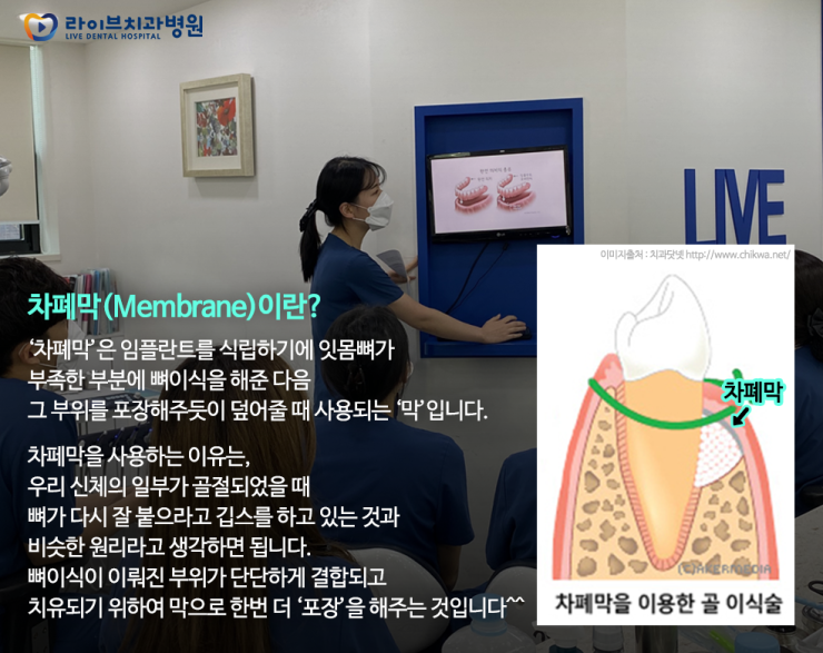 [10월세미나]인천점 스텝세미나 - 임플란트 정의&차폐막 관련 이미지 2