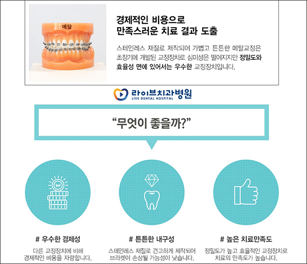 치아교정장치 무슨 차이점이 있나요? 관련 이미지 2