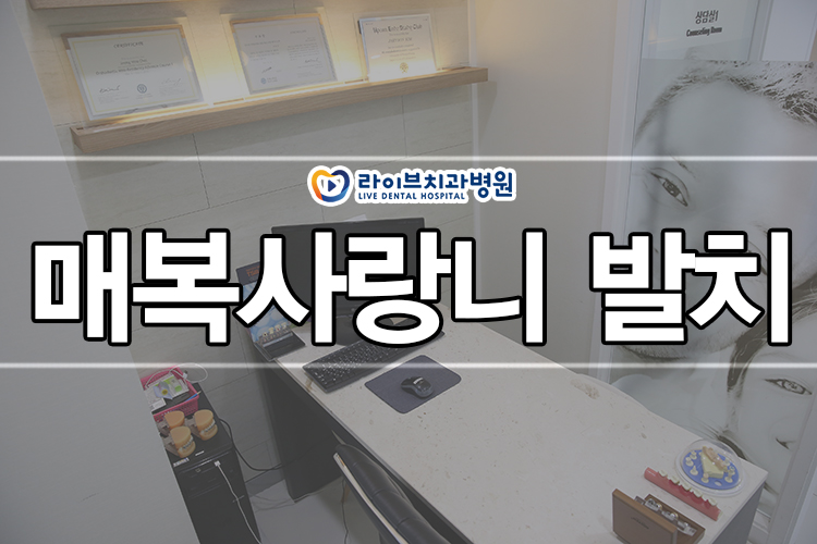 매복사랑니 발치 신중하게 받자 관련 이미지 1