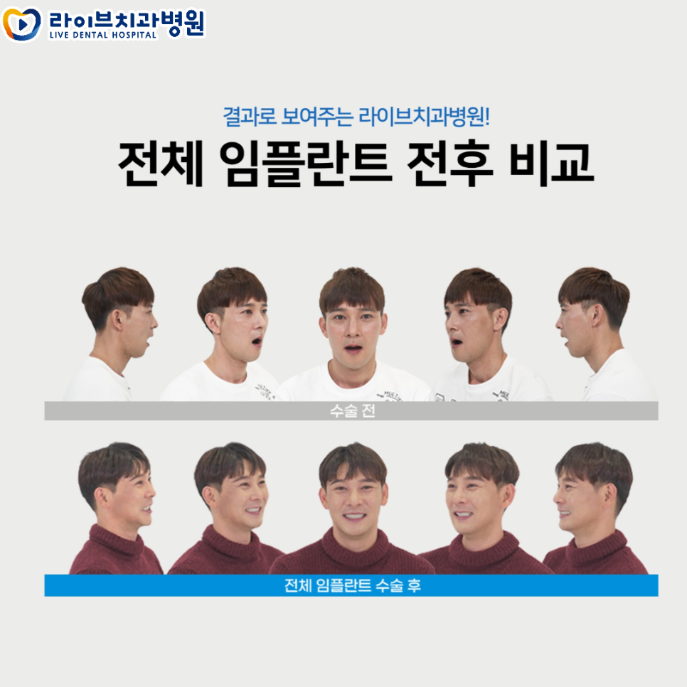 라이브치과병원 리얼스토리 전후 사진! 관련 이미지 3
