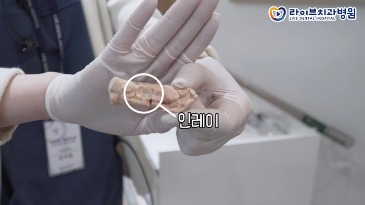라이브치과 VLOG｜보철과 치과위생사의 하루, 보철과업무, 인레이 진료, 일상vlog, 직장인 브이로그 관련 이미지 2