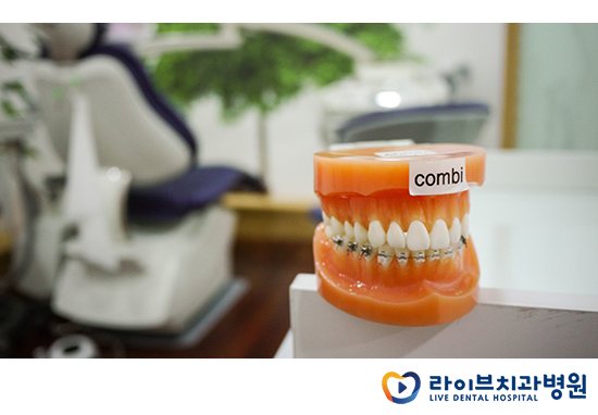 교정기의 다양한 종류를 알아보자! 관련 이미지 7