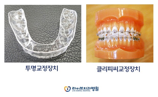 치아교정, 정밀진단은 필수! 관련 이미지 3