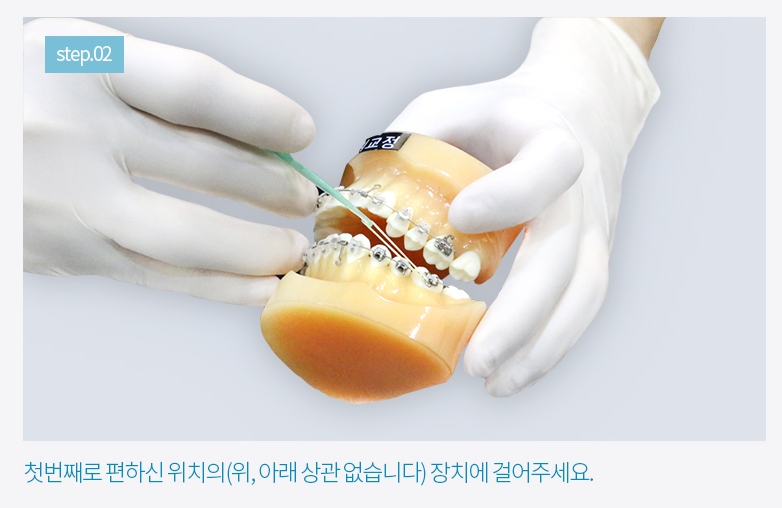 치아교정 고무줄 어렵지 않아요. (feat.영상설명) 관련 이미지 4