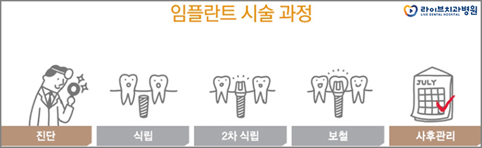 임플란트 과정 미리 알아두고 치료받자 관련 이미지 5