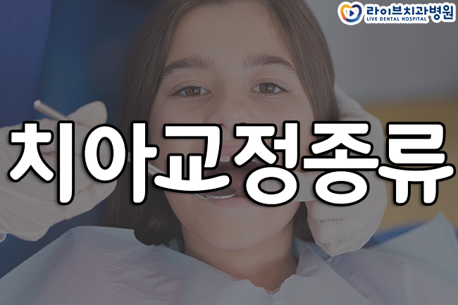 치아교정종류 어떤게 다른가요? 관련 이미지 1