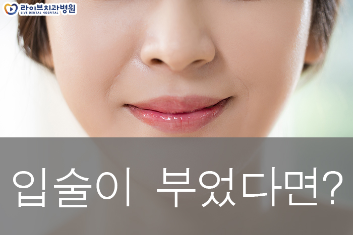 입술이 부었어요 이유가 뭘까 관련 이미지 1
