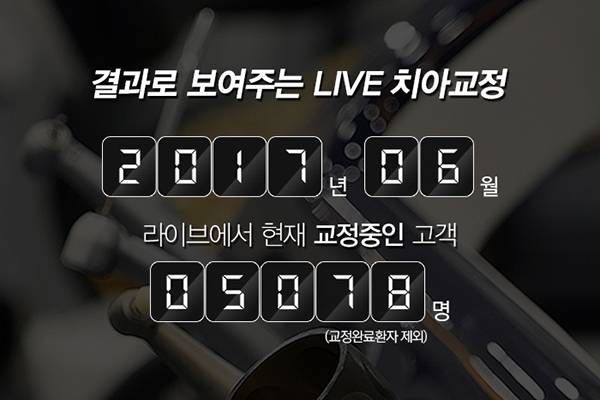 치아교정비용 얼만큼 생각하시나요? 관련 이미지 5