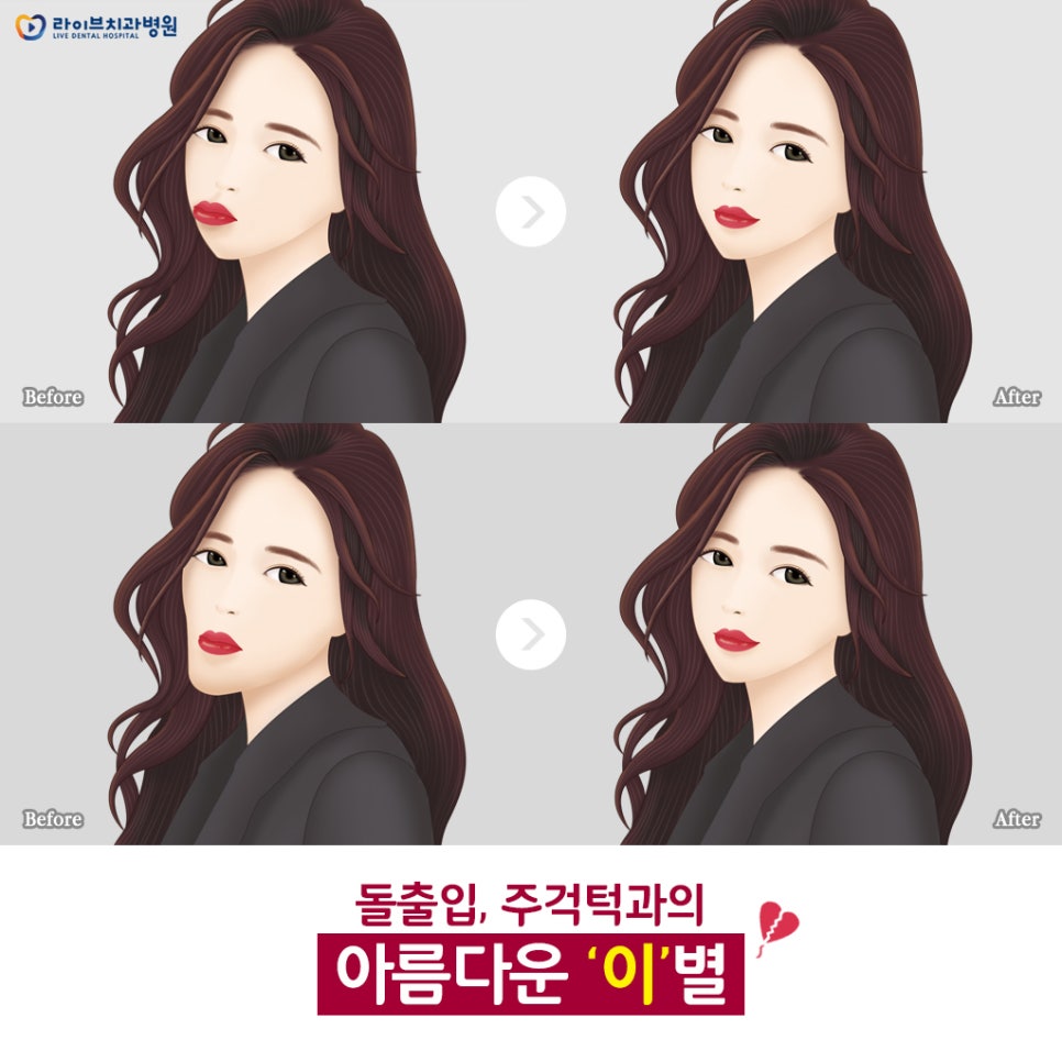 치아교전전후, 나에겐 어떤 변화가 있을까? 관련 이미지 4